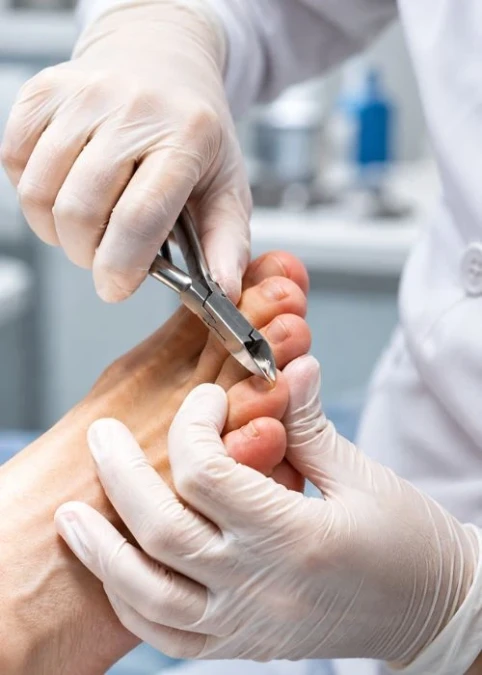 Corte Técnico das Unhas